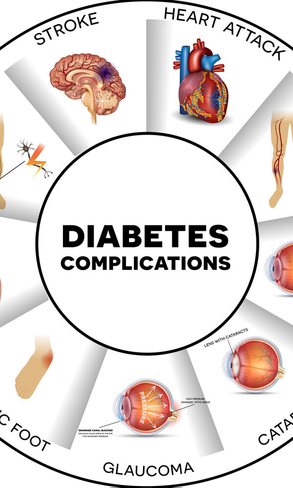 Diabetes Complications