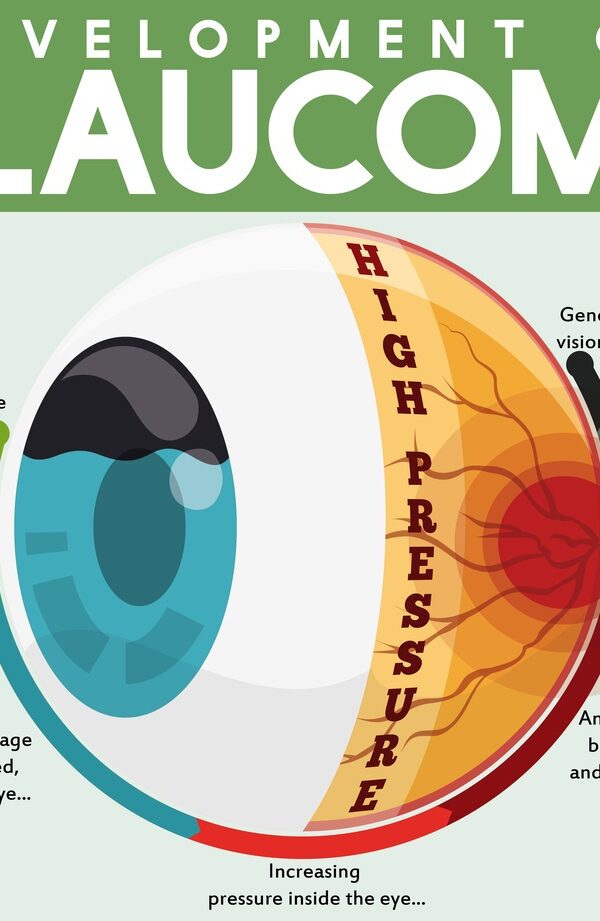 Infographic-poster-with-detailed-effects-of-untreated-glaucoma-disease-showing-the-passing-through-a-good-and-healthy-eye-to-a-rogressive-vision loss