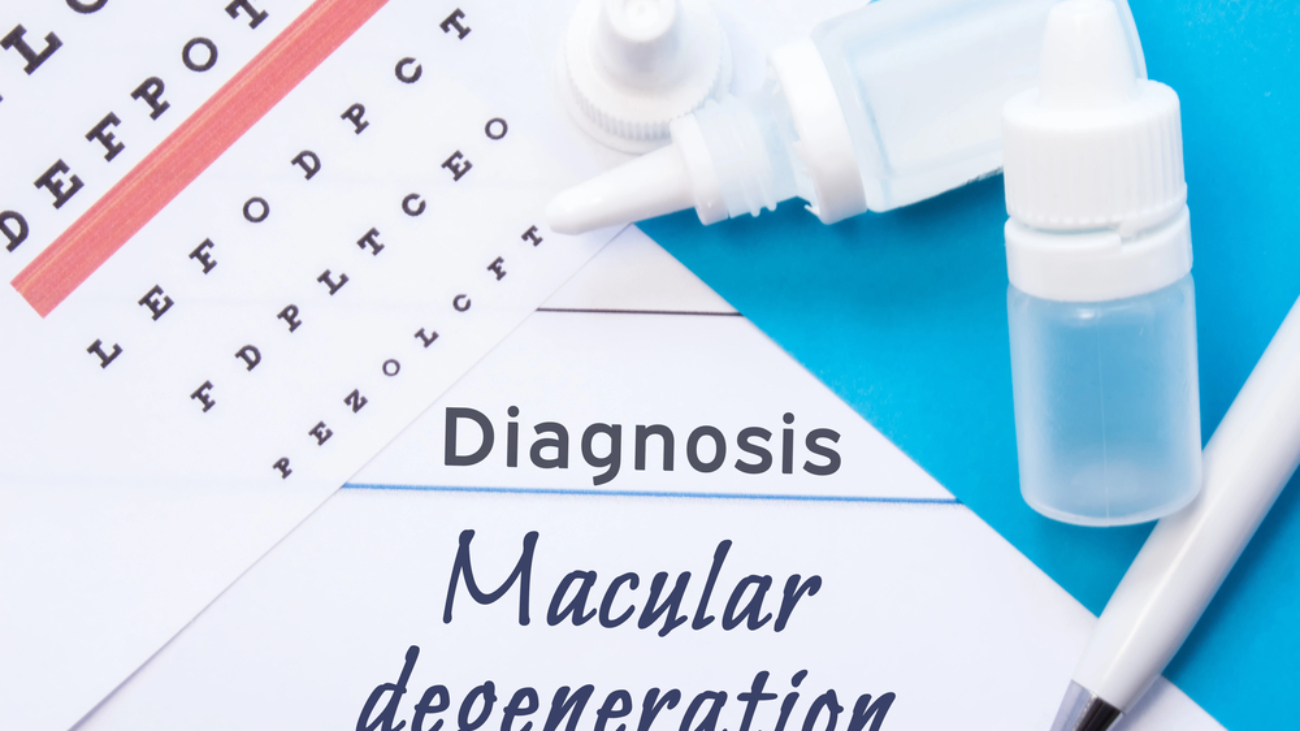 eye chart wtih eye drops and the text Diagnosis - Age-related Macular degeneration